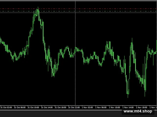 EasyMoney XRay Robot_fix