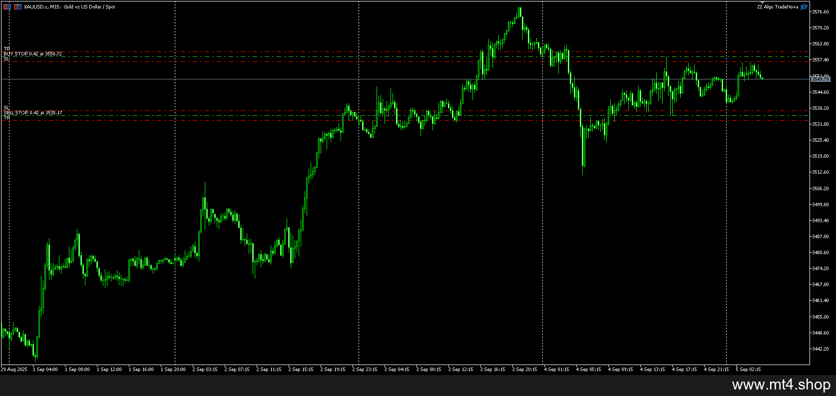 ZZ Algo TradeNova